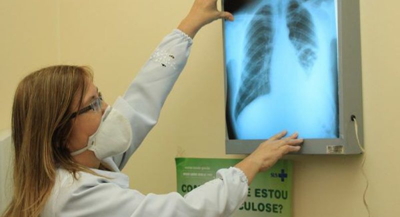 tuberculose, dengue, estrago, brasileiros