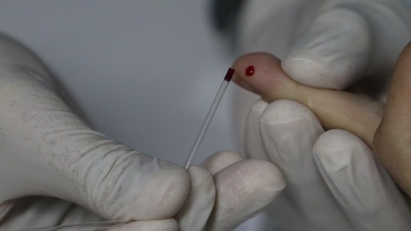 amazonas, casos, coronavirus, obitos
