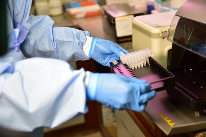 Com mais 2,1 mil, Amazonas chega a 46,4 mil contaminados