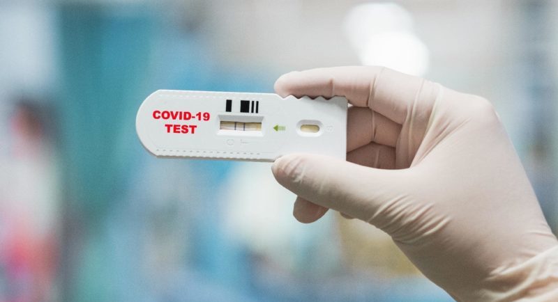 coronavirus, manaus, casos, obitos