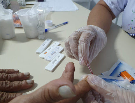 Suspeita de fraude na compra de 10 milhões de kits de teste para covid-19