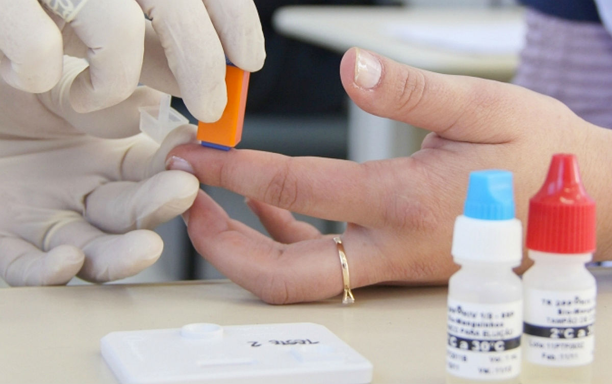 Pazuello cochila e SUS fica sem contrato para exames de aids e hepatites