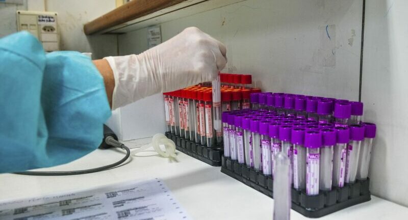 Cientistas anunciam descoberta de como tratar e prevenir coronavírus