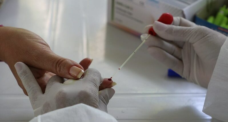 pesquisa, coronavirus, amazonas, japoneses