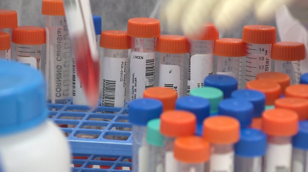 Especialistas explicam teste de covid pela saliva vendido em drogaria