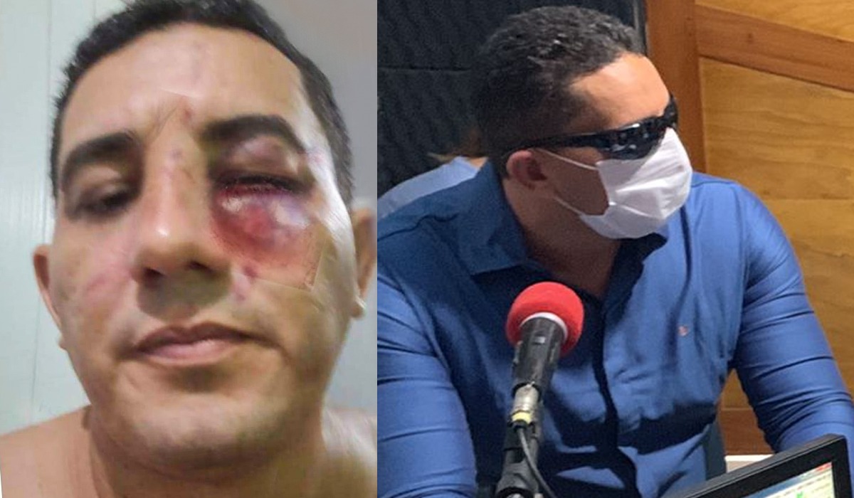 Contas do Prefeito de Borba depois da luta de MMA com o morador Mirico