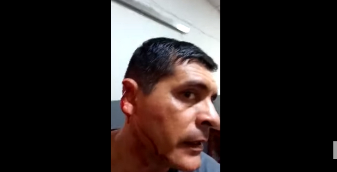 Orelha de capitão PM é arrancada no dente por preso no Amazonas