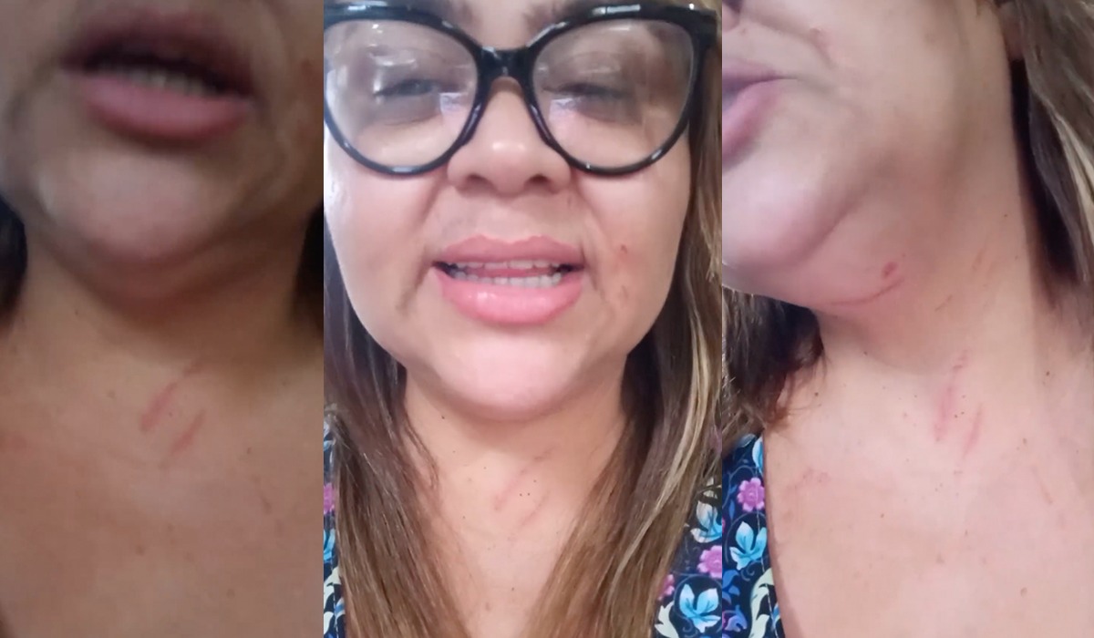 Mara Lima agressão